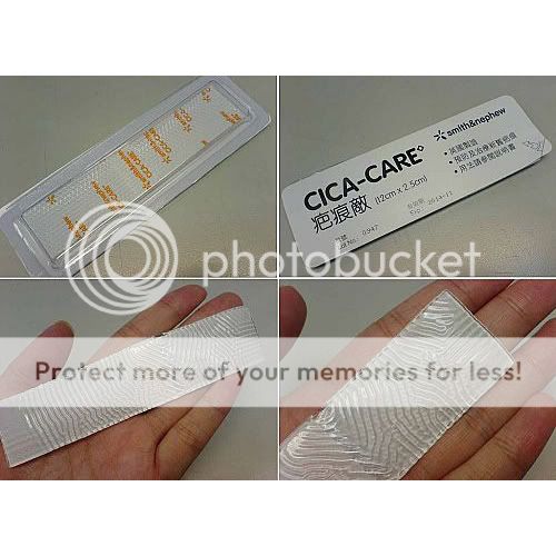 CicaCare Scar Treatment Silicone Gel Sheet 12x2.5cm Wound Reducer SelfAdhesive eBay CicaCare Scar Treatment Silicone Gel Sheet 12x2.5cm Wound Reducer SelfAdhesive eBay