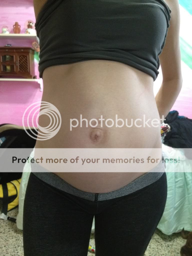 Darker ring around belly button?? BabyCenter